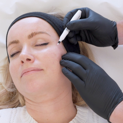 Skin Aesthetics Nimmo Clinic 2 Botox in cobham