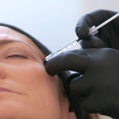 botox in chelsea